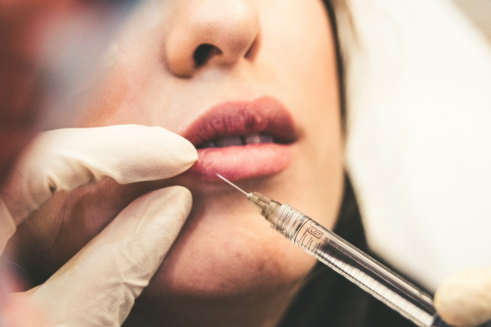 Alles wat moet je weten over botox Tilburg